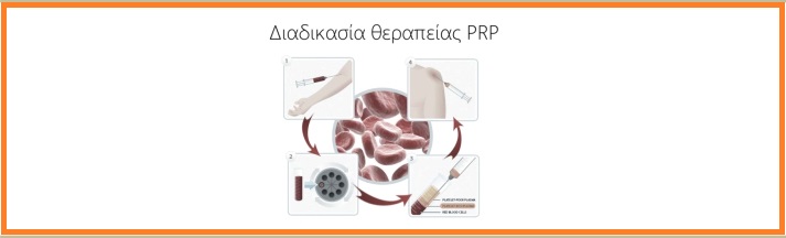 Θεραπεία με PRP και βλαστοκύτταρα - Αγγελόπουλος Αθανάσιος - Ορθοπεδικός χειρούργος